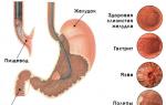 Cum se face gastroscopia stomacului
